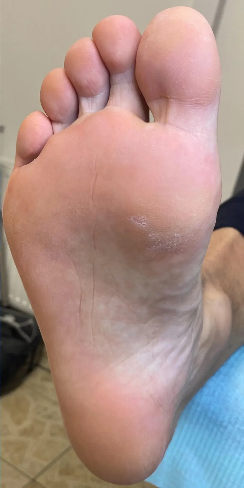 pedicure podologiczny po zabiegu