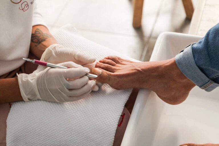 wrastający paznokieć zabieg